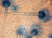 Bild Schimmelpilz unter dem Mikroskop (2)